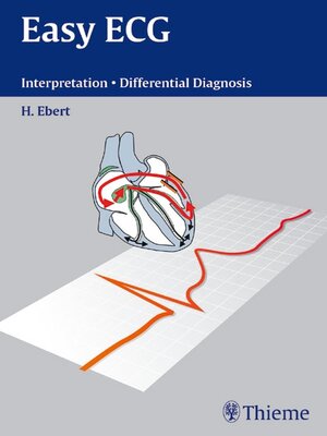 cover image of Easy ECG